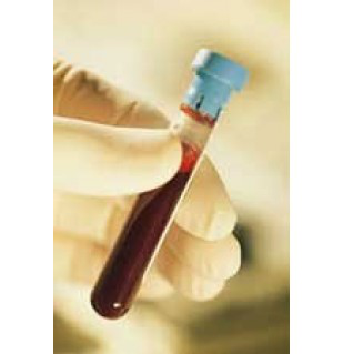 Smart Monitor Systems â€“ Alarm System on Refrigerators for Blood