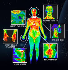 How does thermal imaging work